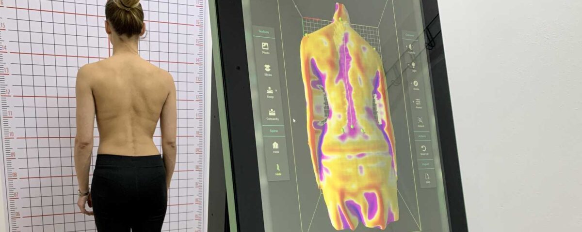 Topografska procena posture