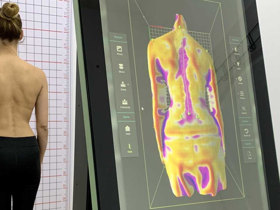 Topografska procena posture